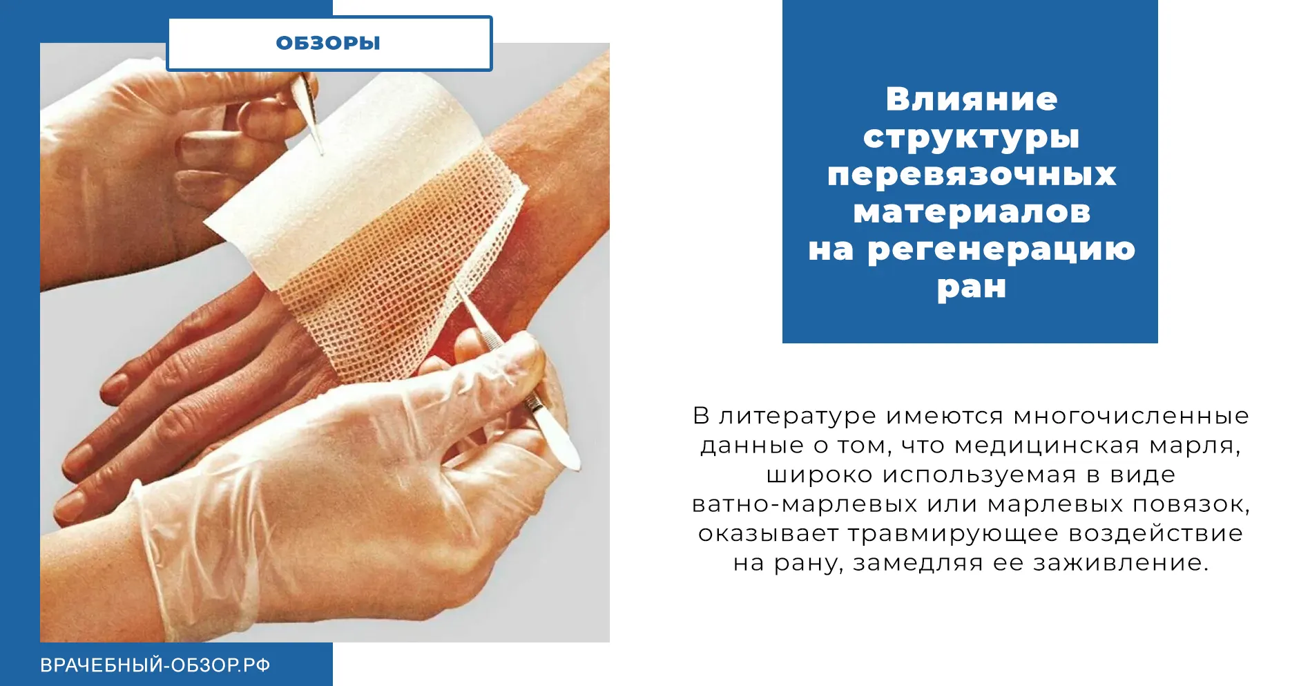 Влияние структуры перевязочных материалов на регенерацию ран
