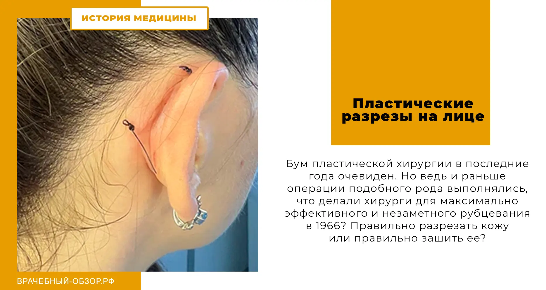 Пластические разрезы на лице