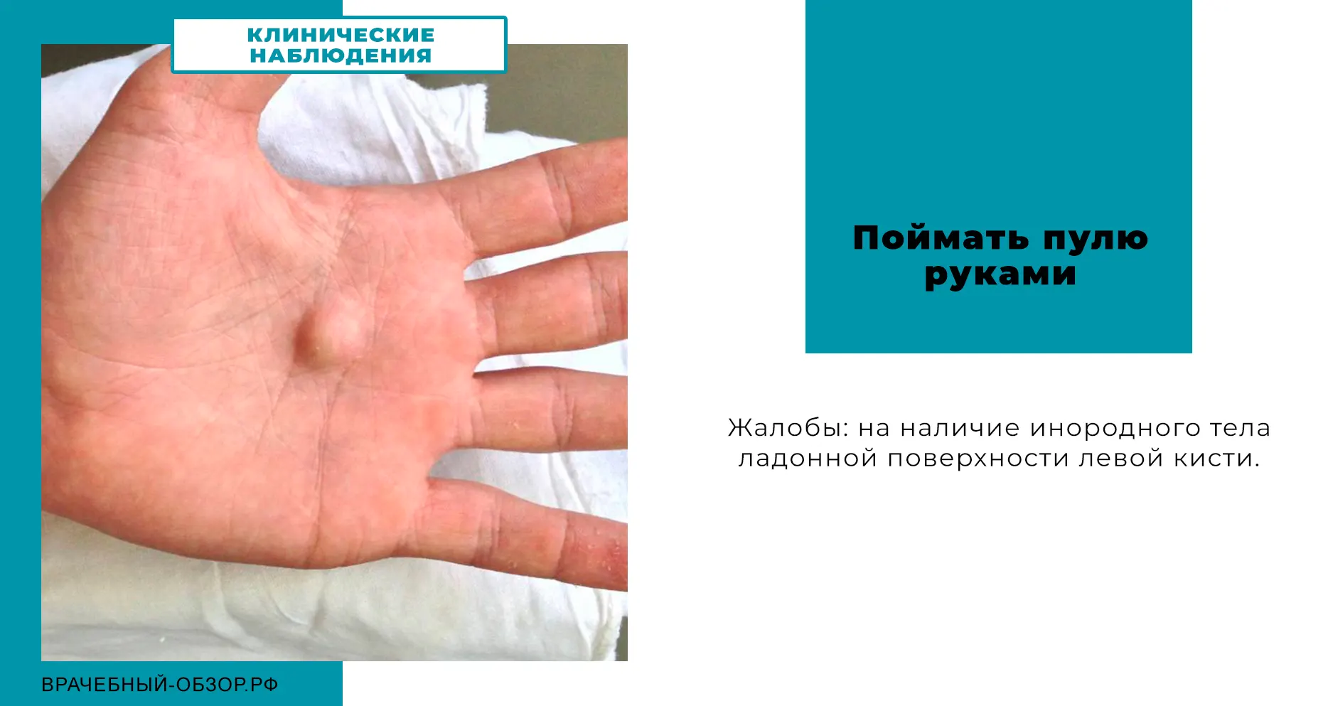Поймать пулю руками